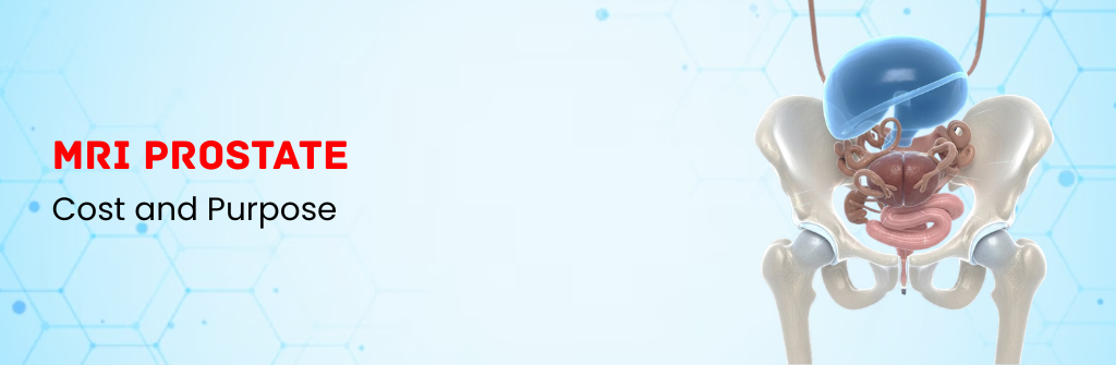 MRI Prostate Cost and Purpose